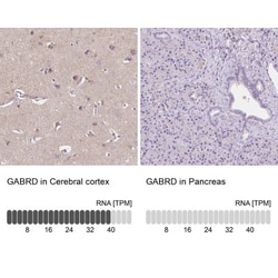 GABA-A R delta Antibody, Novus Biologicals:Antibodies:Primary Antibodies
